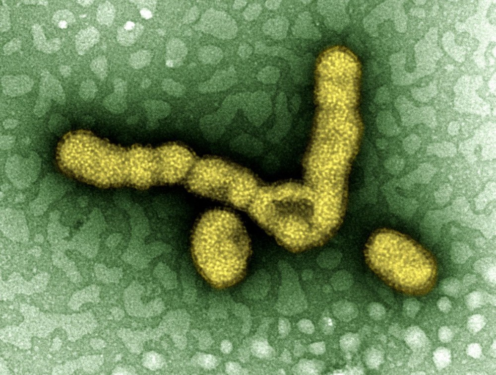 Criança morre com suspeita de H1N1 após surto da doença em escola